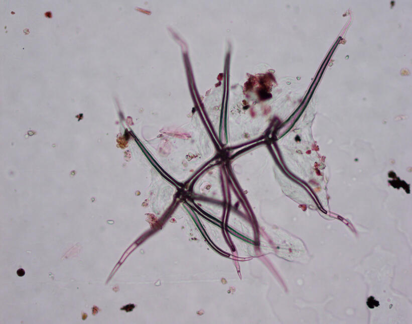 Pollen - photos taken by Dr. Letty Weger