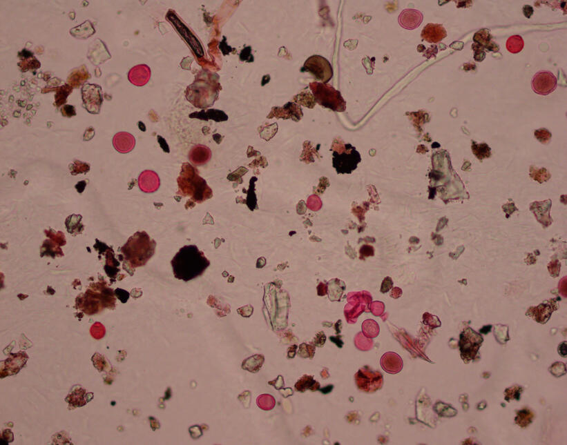 Pollen - photos taken by Dr. Letty Weger